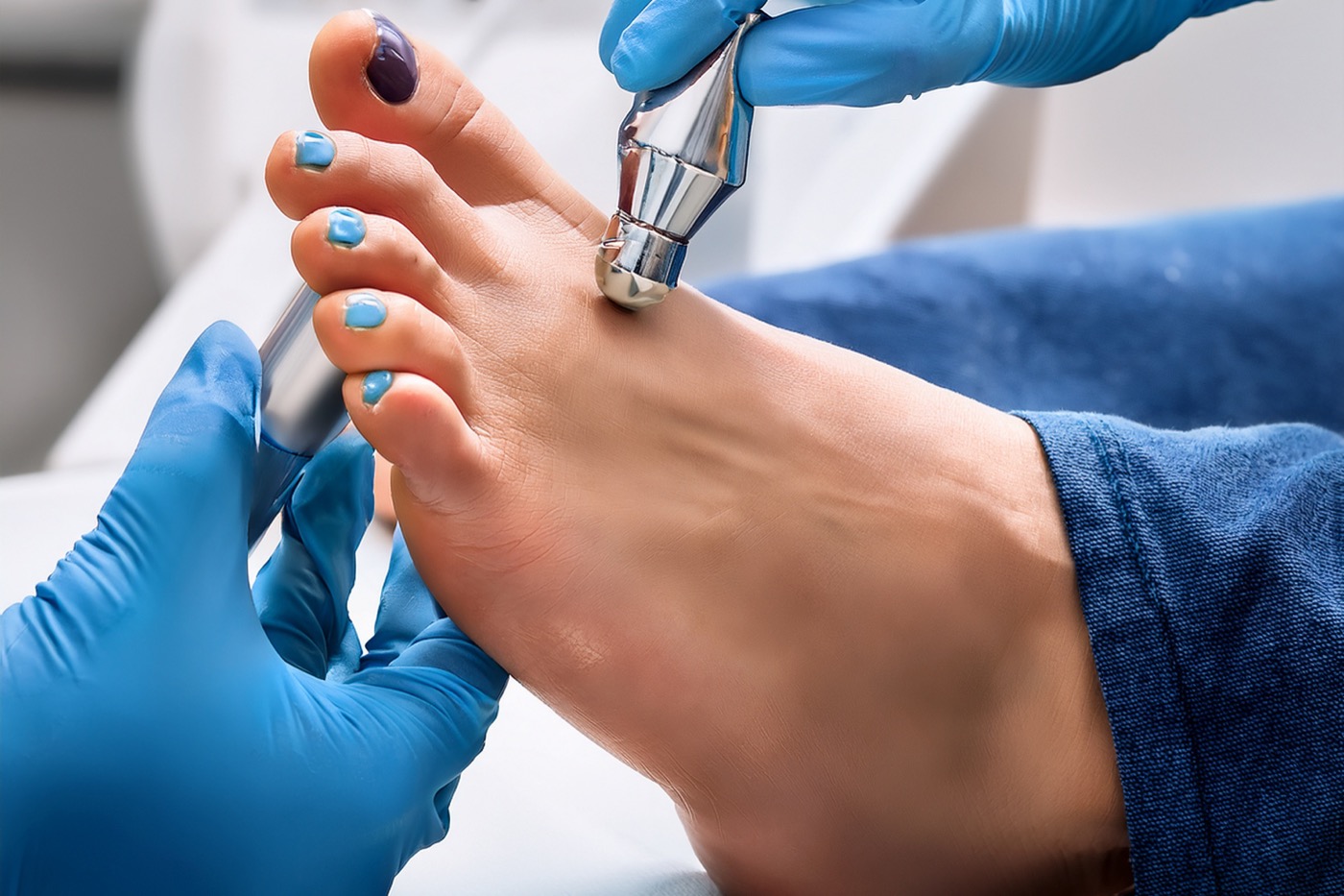 Fußpflege mit Fräsgerät und lackierten Fußnägeln